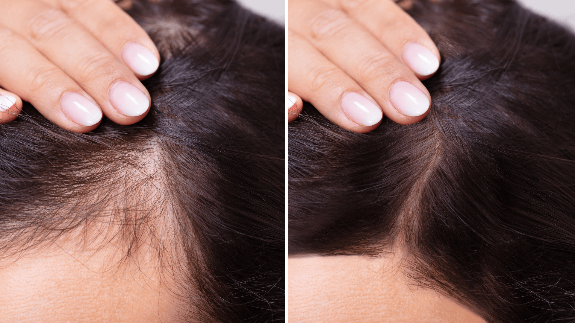 Reduza a Queda de Cabelo com Tratamentos Eficazes